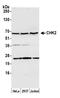 Checkpoint Kinase 2 antibody, A300-620A, Bethyl Labs, Western Blot image 