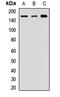 Tight Junction Protein 2 antibody, LS-C668207, Lifespan Biosciences, Western Blot image 