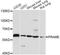 Preferentially Expressed Antigen In Melanoma antibody, A14507, ABclonal Technology, Western Blot image 