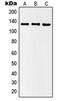 Histone Deacetylase 5 antibody, GTX32287, GeneTex, Western Blot image 