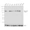 Actinin Alpha 1 antibody, PA5-44889, Invitrogen Antibodies, Western Blot image 