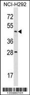Actin Like 7B antibody, 58-536, ProSci, Western Blot image 