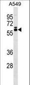 Dihydrouridine Synthase 2 antibody, LS-C159494, Lifespan Biosciences, Western Blot image 