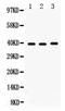 Midkine antibody, LS-C357600, Lifespan Biosciences, Western Blot image 