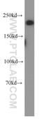 Myosin Heavy Chain 10 antibody, 19673-1-AP, Proteintech Group, Western Blot image 