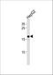 High Mobility Group AT-Hook 2 antibody, A00436-1, Boster Biological Technology, Western Blot image 