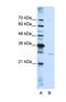 EMG1 N1-Specific Pseudouridine Methyltransferase antibody, NBP1-57410, Novus Biologicals, Western Blot image 