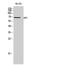 SH2 and PH domain-containing adapter protein APS antibody, A09167, Boster Biological Technology, Western Blot image 