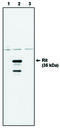 Ras Like Without CAAX 1 antibody, MBS395250, MyBioSource, Western Blot image 