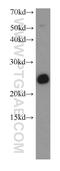 Synaptosome Associated Protein 25 antibody, 10007-1-AP, Proteintech Group, Western Blot image 