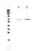 Caseinolytic Mitochondrial Matrix Peptidase Chaperone Subunit antibody, PA5-79052, Invitrogen Antibodies, Western Blot image 