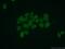Coiled-coil domain-containing protein 86 antibody, 14947-1-AP, Proteintech Group, Immunofluorescence image 