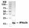 Interferon Alpha 2 antibody, NB100-75556, Novus Biologicals, Western Blot image 