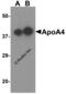 Apolipoprotein A4 antibody, 5929, ProSci, Western Blot image 