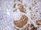 Alpha-Methylacyl-CoA Racemase antibody, LS-C796979, Lifespan Biosciences, Immunohistochemistry paraffin image 