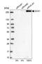 GCN1 antibody, NBP1-83382, Novus Biologicals, Western Blot image 