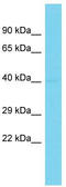 Scratch Family Transcriptional Repressor 1 antibody, TA329108, Origene, Western Blot image 