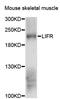 LIF Receptor Subunit Alpha antibody, LS-C747857, Lifespan Biosciences, Western Blot image 