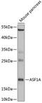 Anti-Silencing Function 1A Histone Chaperone antibody, 22-288, ProSci, Western Blot image 