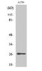 Cyclin Dependent Kinase Inhibitor 1B antibody, A00173S10, Boster Biological Technology, Western Blot image 
