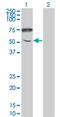 Ectonucleotide Pyrophosphatase/Phosphodiesterase Family Member 5 antibody, MA5-22431, Invitrogen Antibodies, Western Blot image 