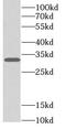 Firefly Luciferase antibody, FNab09877, FineTest, Western Blot image 
