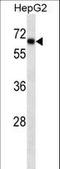 SRY-Box 9 antibody, LS-C161406, Lifespan Biosciences, Western Blot image 