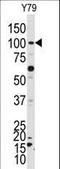 NIMA Related Kinase 4 antibody, LS-C101168, Lifespan Biosciences, Western Blot image 