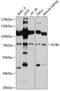 IlvB Acetolactate Synthase Like antibody, 14-072, ProSci, Western Blot image 