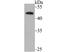 DEK Proto-Oncogene antibody, A04410, Boster Biological Technology, Western Blot image 