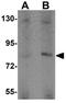 Amyloid Beta Precursor Protein Binding Family A Member 2 antibody, GTX85144, GeneTex, Western Blot image 