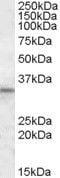 HCLS1-associated protein X-1 antibody, PA5-19077, Invitrogen Antibodies, Western Blot image 
