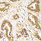 Rho Associated Coiled-Coil Containing Protein Kinase 2 antibody, LS-C334228, Lifespan Biosciences, Immunohistochemistry frozen image 