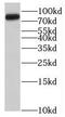 Suppression Of Tumorigenicity 5 antibody, FNab08268, FineTest, Western Blot image 