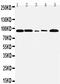 Fibroblast Growth Factor Receptor 1 antibody, PA1477, Boster Biological Technology, Western Blot image 