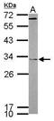 Four And A Half LIM Domains 2 antibody, GTX114071, GeneTex, Western Blot image 