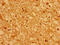 mASH-1 antibody, LS-C669661, Lifespan Biosciences, Immunohistochemistry paraffin image 