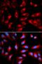 Dynamin 1 Like antibody, LS-C332186, Lifespan Biosciences, Immunofluorescence image 