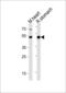 GATA Binding Protein 6 antibody, GTX03398, GeneTex, Western Blot image 