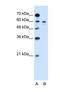 Tyrosinase antibody, NBP1-69516, Novus Biologicals, Western Blot image 