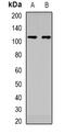 DEAD/H-Box Helicase 11 antibody, abx141408, Abbexa, Western Blot image 