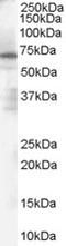 PARP2 antibody, EB07098, Everest Biotech, Western Blot image 