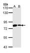 Protein Kinase C Zeta antibody, PA5-29337, Invitrogen Antibodies, Western Blot image 