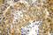 Heat Shock Protein 90 Alpha Family Class B Member 1 antibody, 13171-1-AP, Proteintech Group, Immunohistochemistry paraffin image 