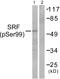 Serum response factor antibody, PA5-38092, Invitrogen Antibodies, Western Blot image 