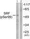 Serum Response Factor antibody, PA5-38092, Invitrogen Antibodies, Western Blot image 