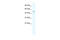 TATA-Box Binding Protein Associated Factor 5 Like antibody, 27-636, ProSci, Western Blot image 