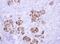 ATP Synthase F1 Subunit Delta antibody, NBP1-32365, Novus Biologicals, Immunohistochemistry paraffin image 