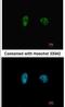 Checkpoint Kinase 2 antibody, NB100-500, Novus Biologicals, Immunocytochemistry image 