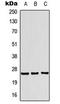 Translin antibody, LS-C354107, Lifespan Biosciences, Western Blot image 